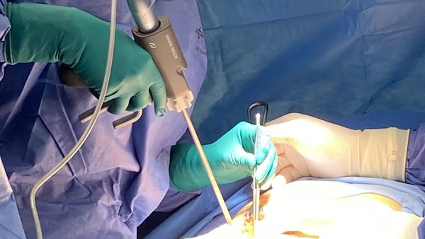 Neues Ultraschallskalpell für chirurgische Eingriffe