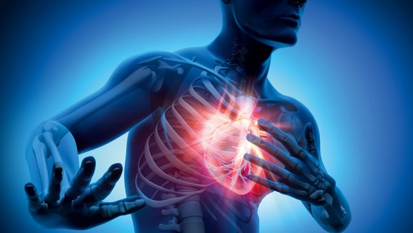 Stechen in der Brust - Zeichen für einen Herzinfarkt?